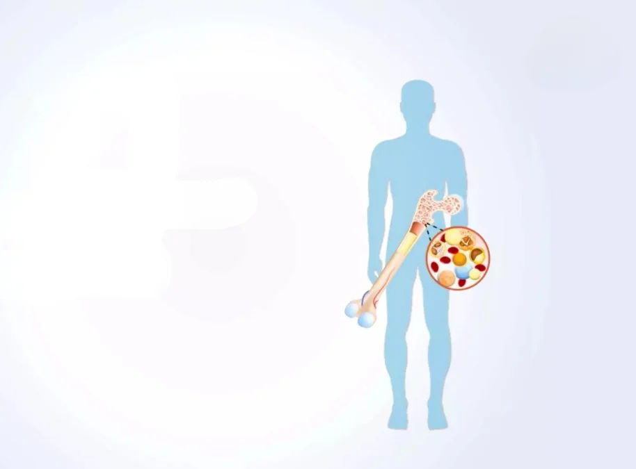 Bone marrow transplant in Hyderabad explained by Dr. G. Stitha Pragna