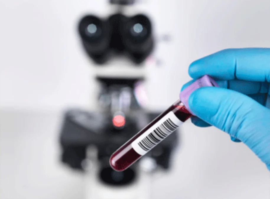 How blood tests help spot cancer relapse early in Hyderabad